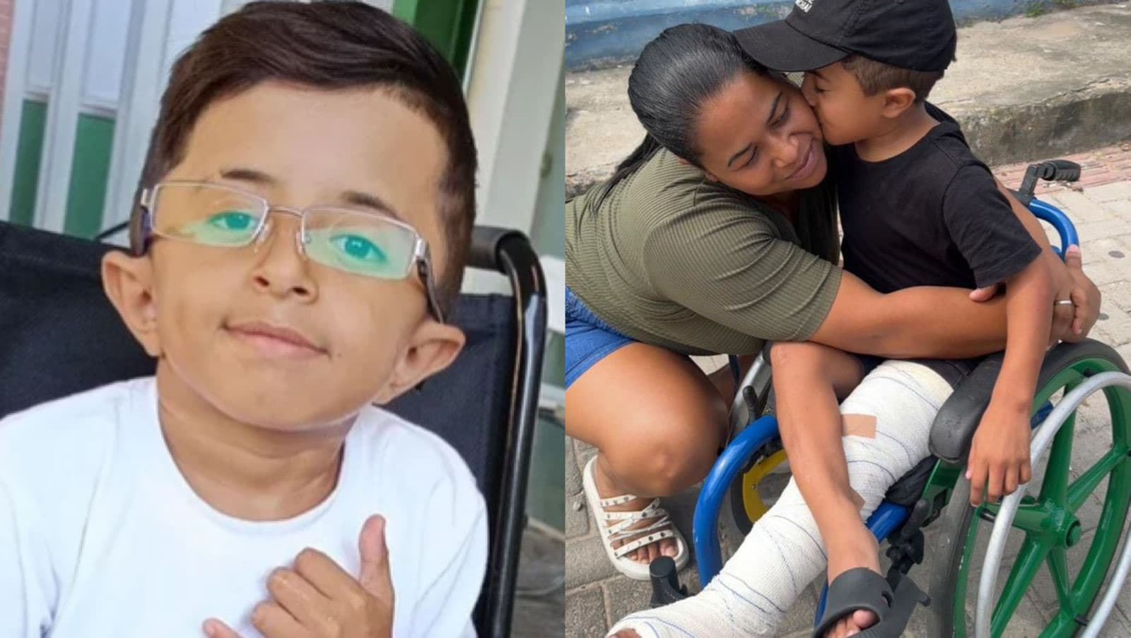 “Quero correr e jogar bola”: Criança enfrenta doença rara, já quebrou ossos 34 vezes e precisa de ajuda em SC