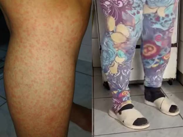 “Portas fechadas a 34°C”: moradores vivem reféns de infestação de maruins em SC