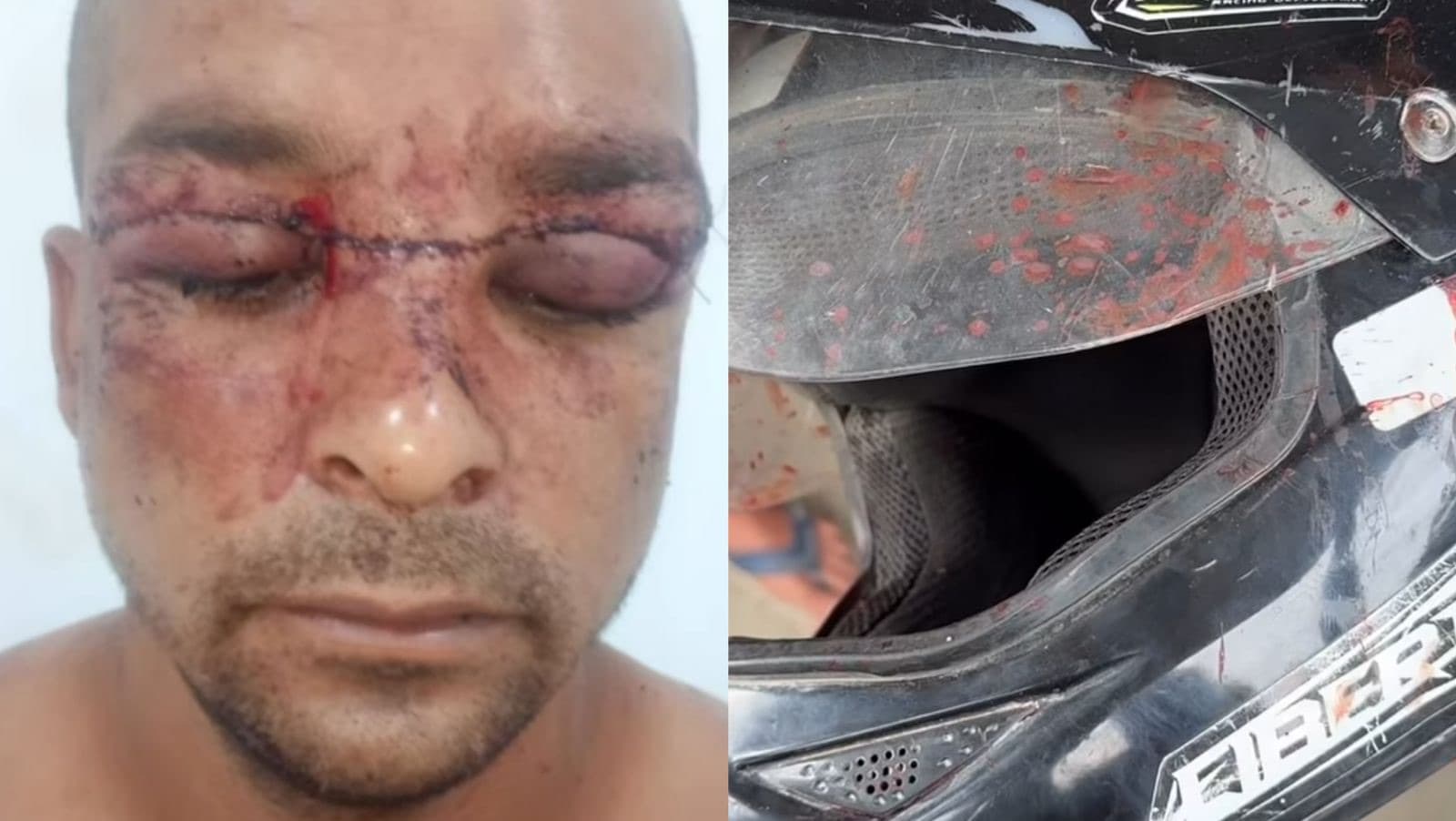 Motociclista leva 100 pontos após ter rosto cortado por linha de cerol na BR-470 em Navegantes