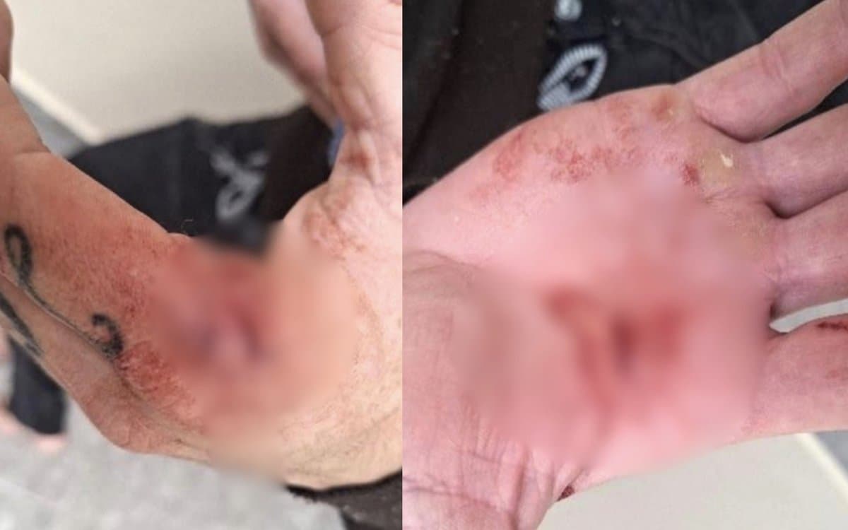 Madrasta dá surra de vassoura em criança de 9 anos em São João Batista; pai reagiu e levou tesouradas
