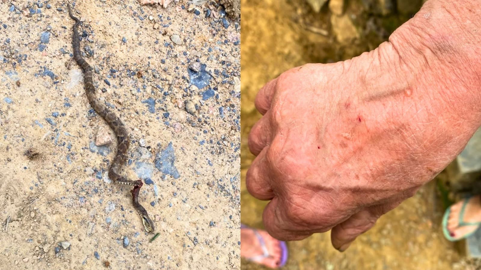 Jararaca “camuflada” entre as plantas, dá bote e pica mão de idosa durante limpeza do jardim no Alto Vale