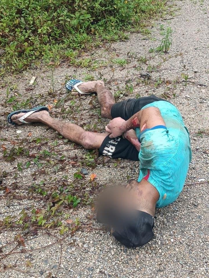 Homem diz que foi deixado dois dias amarrado em cima de formigueiro em Biguaçu