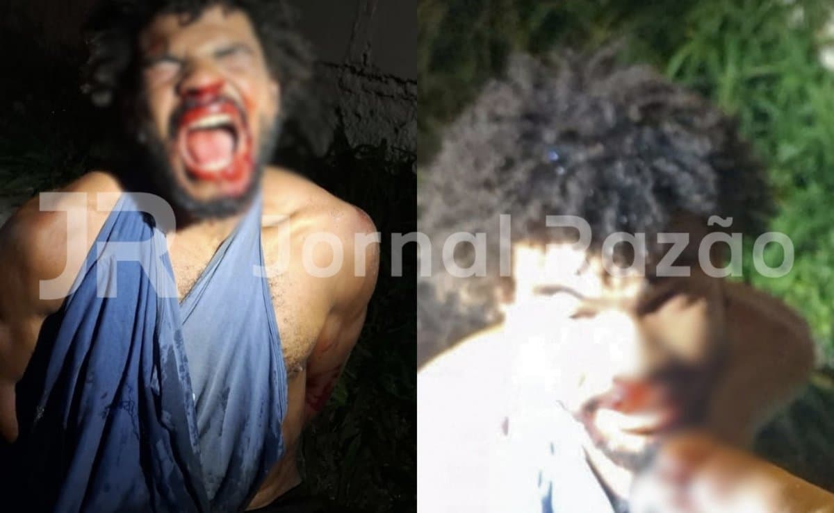 Antonio Lucas Marques Dias foi preso pela PMSC depois de morder a mão de um policial em Criciúma