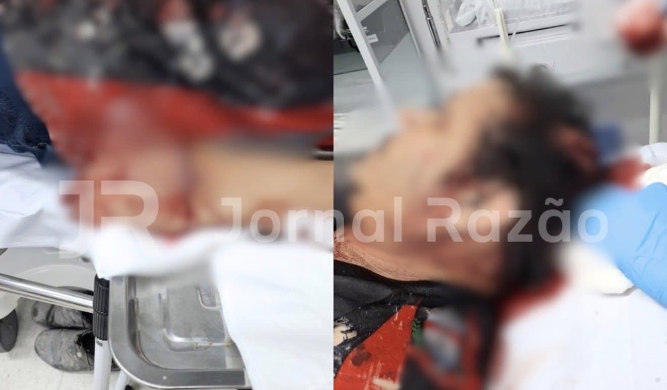 “Me dá o celular”: pintor leva cinco golpes de facão ao se negar a entregar aparelho em Massaranduba