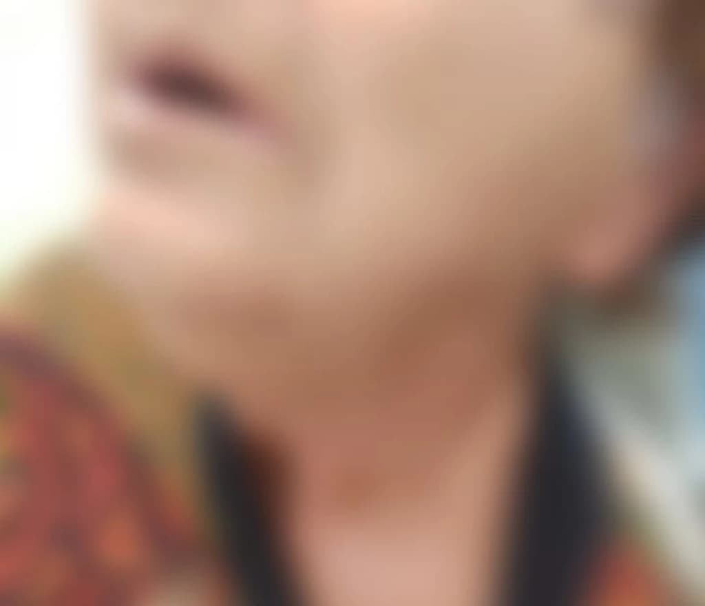 Idosa de 61 anos sofre agressões frequentes de filhas em SC