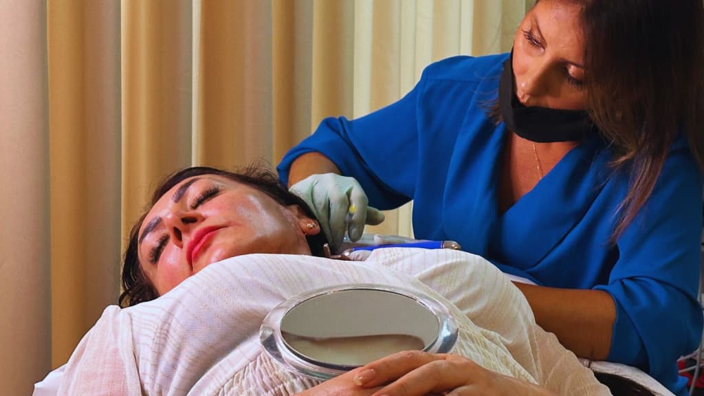 Intradermoterapia Capilar