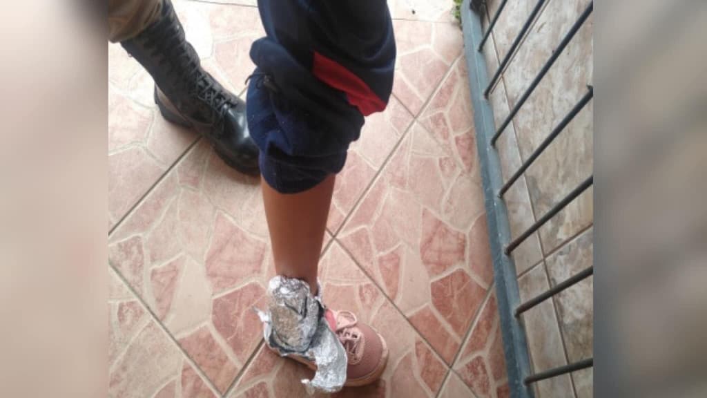 Mulher é presa por tráfico de drogas após cobrir tornozeleira eletrônica com papel alumínio