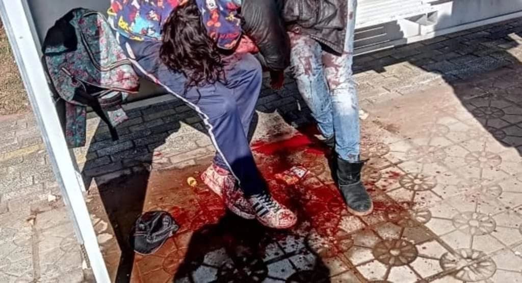 Casal ensanguentados dá susto em quem passava em avenida