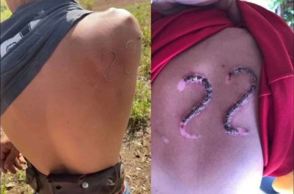 Adolescente faz marca com ferro o número do Presidente Bolsonaro