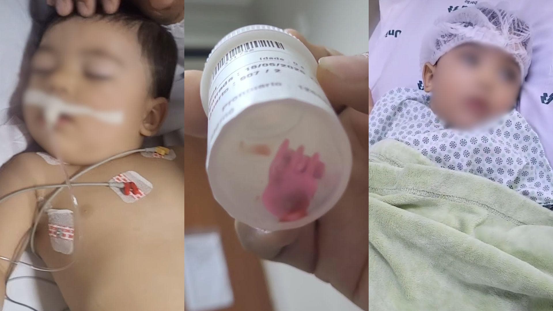 “Por pouco meu filho não morreu”: bebê acaba na UTI após engolir objeto inacreditável em creche