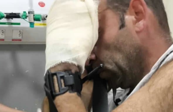 Homem quase perde a mão com esmerilhadeira e é salvo por PMs após corrida contra o tempo em Blumenau