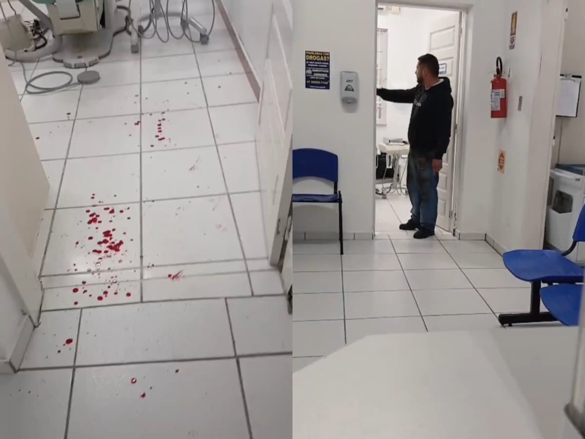 Criança de 10 anos sai sangrando de consulta e pai parte para cima de dentista em Blumenau