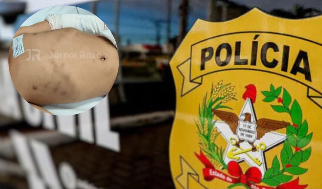 Mãe e padrasto são presos após morte de criança de 2 anos internada com o crânio fraturado em SC