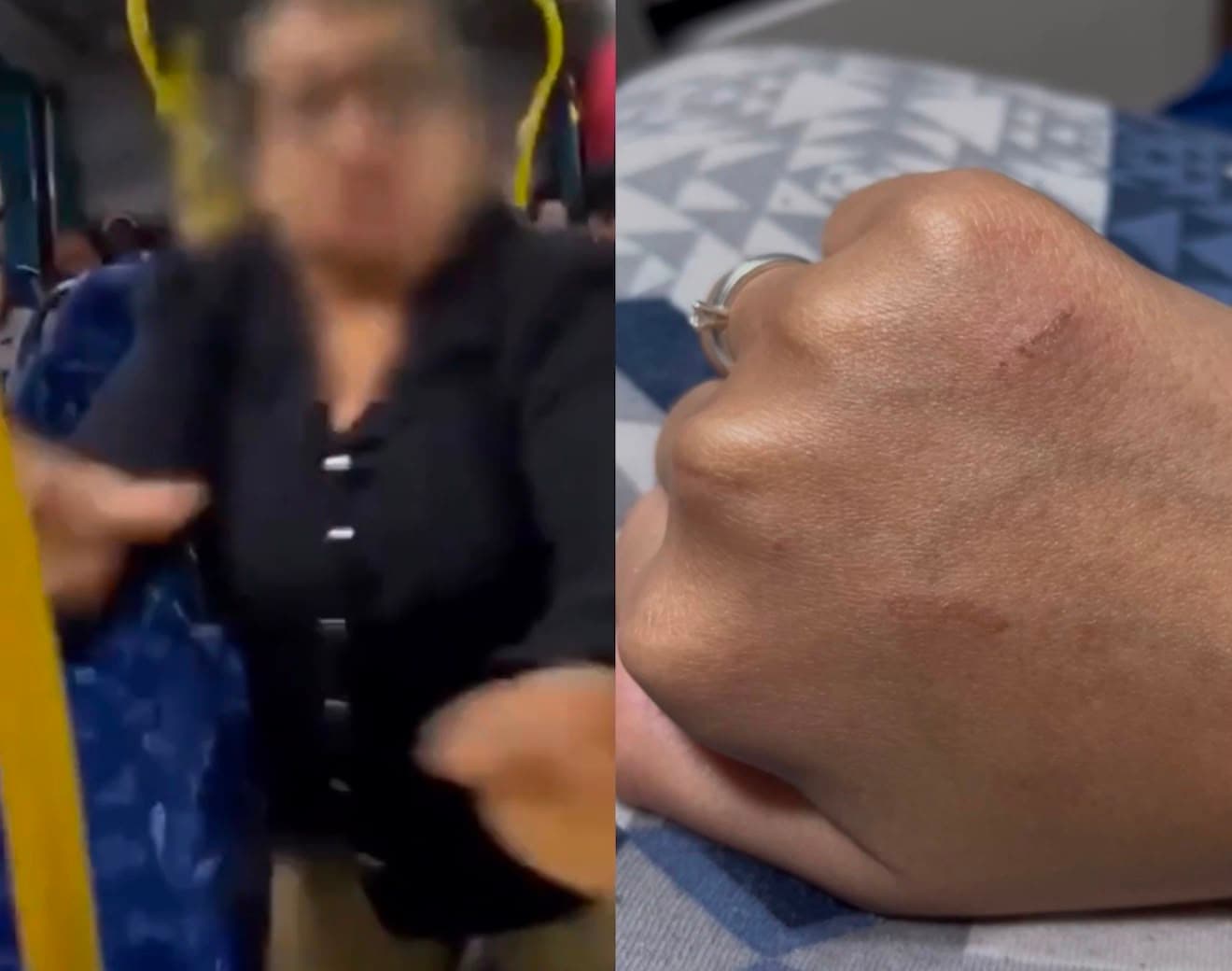 Jovem relata ter sido arranhada, chutada e empurrada por mulher após discussão em ônibus em SC