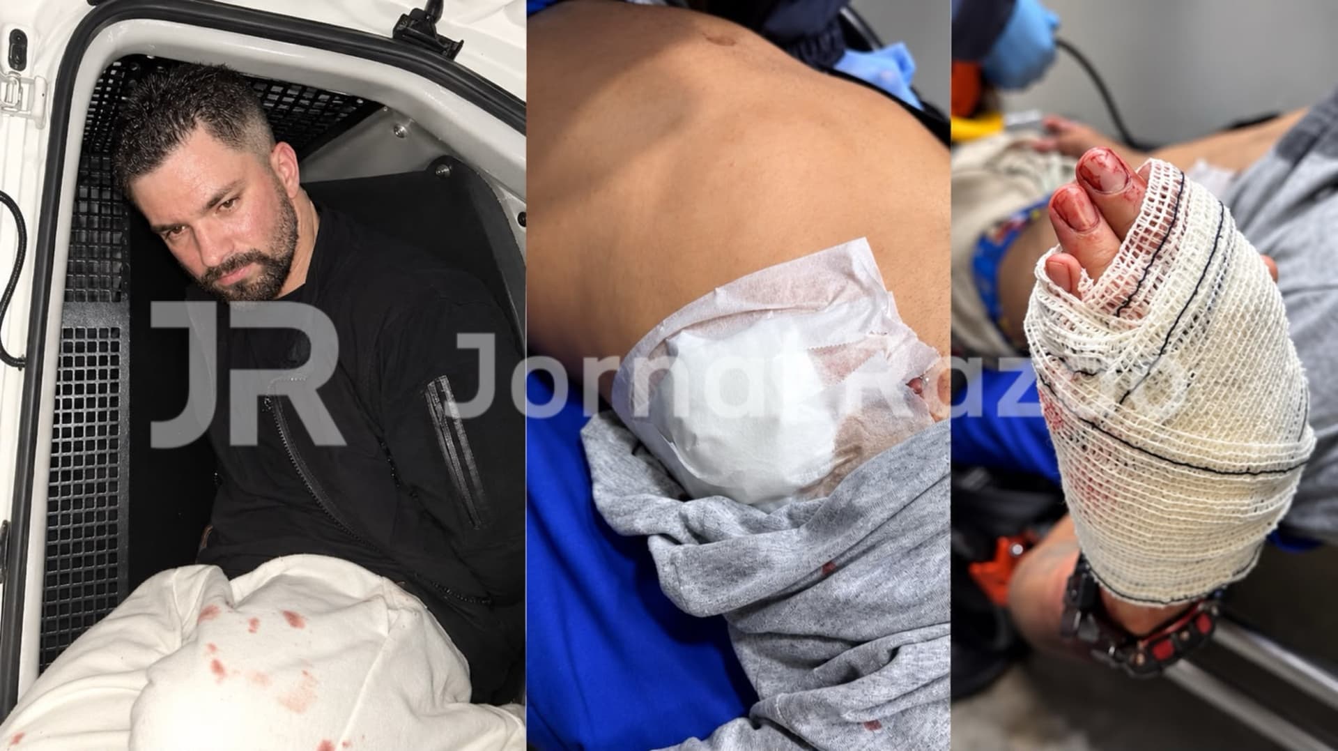 Homem é preso após decepar dedo da mão do namorado em Balneário Camboriú