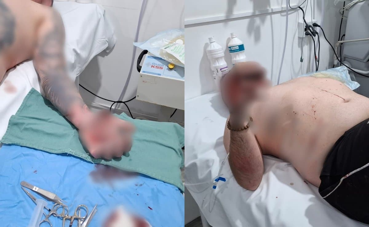 Ataque misterioso no Vale do Rio Tijucas termina com homem coberto de sangue no hospital