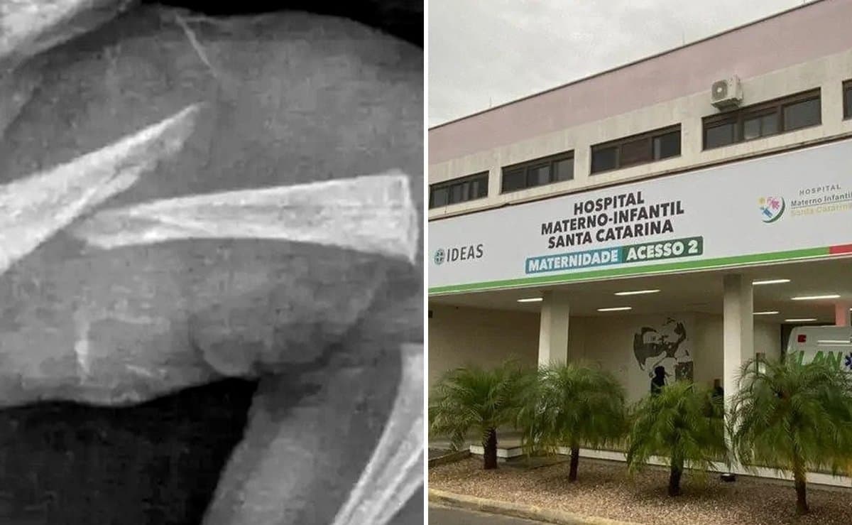 Com ‘perspectiva de gênero’, TJSC absolve mãe de 16 anos acusada de quebrar braço e perna do filho bebê em SC