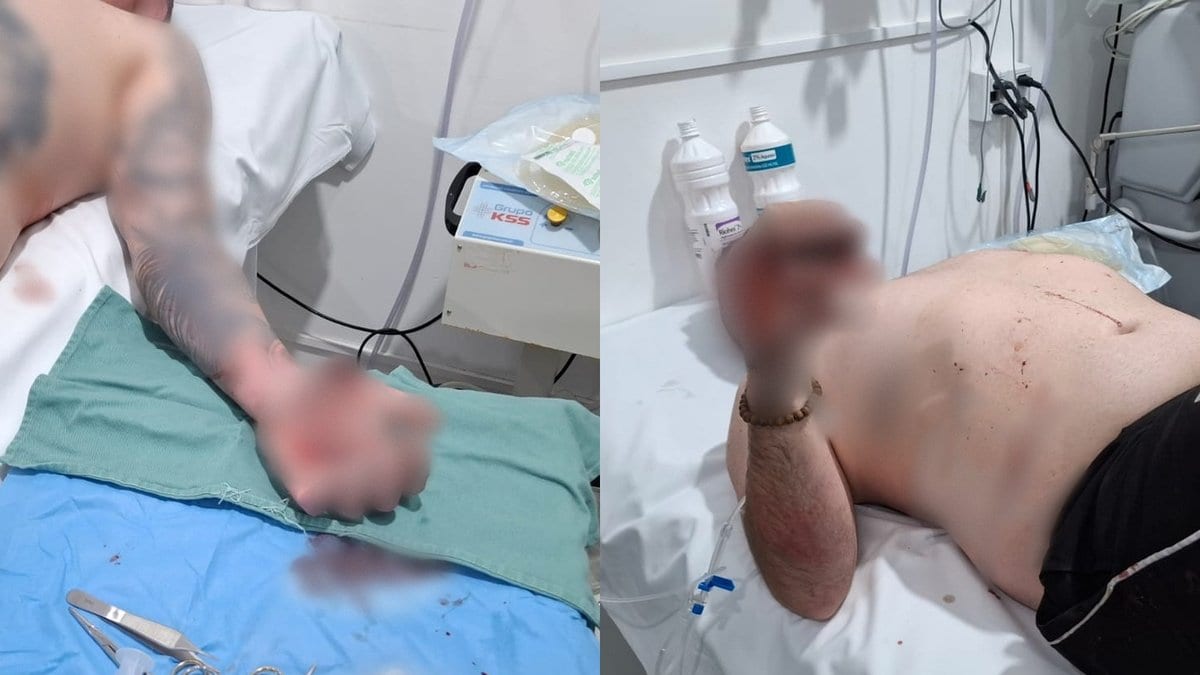 Ataque misterioso no Vale do Rio Tijucas termina com homem coberto de sangue no hospital