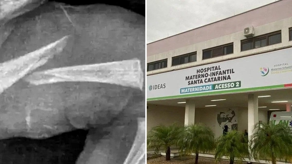 Com “perspectiva de gênero”, TJSC absolve mãe de 16 anos acusada de quebrar braço e perna do filho bebê em SC