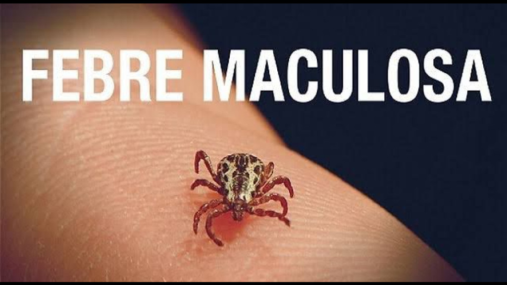 OFICIAL: ‘Febre Maculosa’ é confirmada em Canelinha