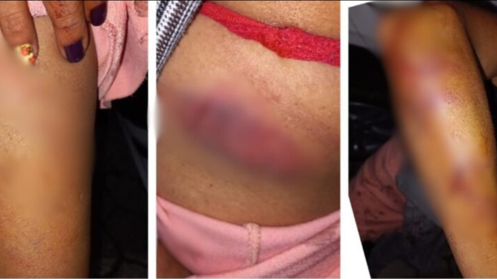 Mulher é agredida com barra de ferro pelo namorado em Nova Trento