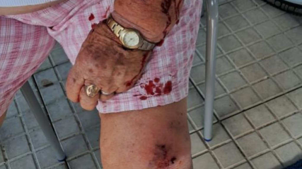 Idosa é atacada por pitbull em frente à escola de Itajaí