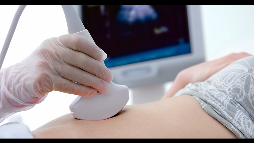 Famílias de Tijucas podem gravar ultrassom de bebês por apenas R$ 30