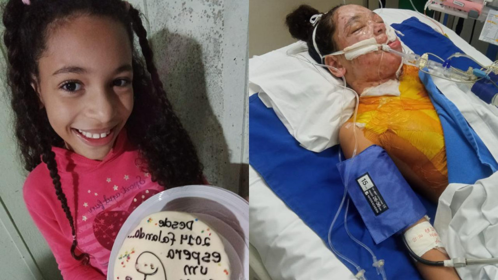 "Milagre": acidente doméstico quase mata menina de 10 anos
