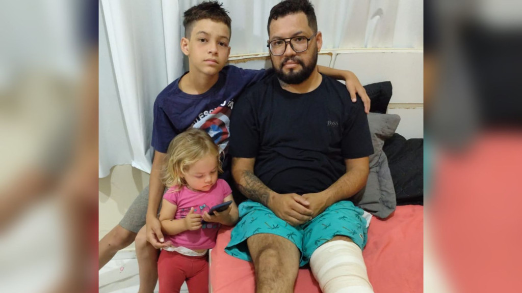 Motoboy quebra perna em duas partes após ser atropelado por motorista alucinado em Itapema