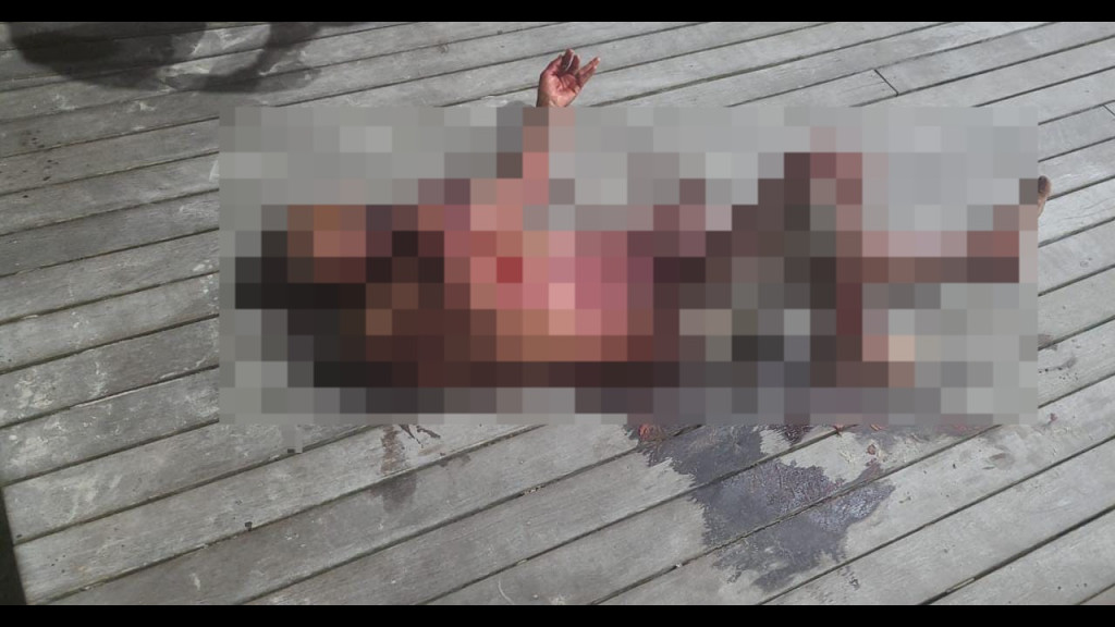Homem em situação de rua sofre tentativa de assassinato em Itapema