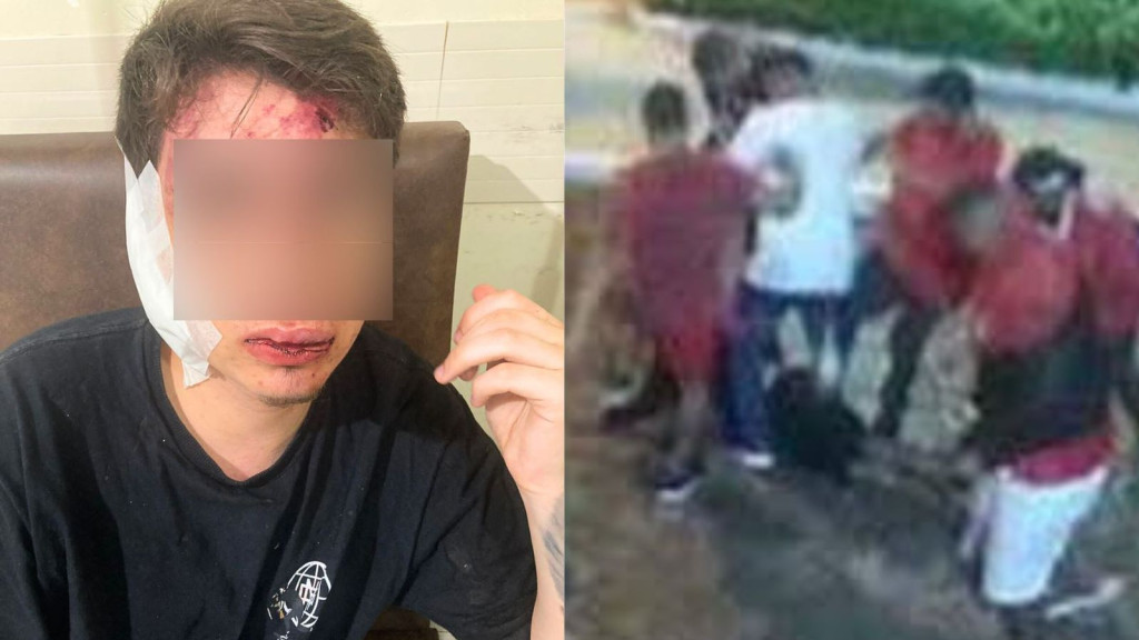 Adolescente é espancado em Tijucas, perde dentes e quase fica cego