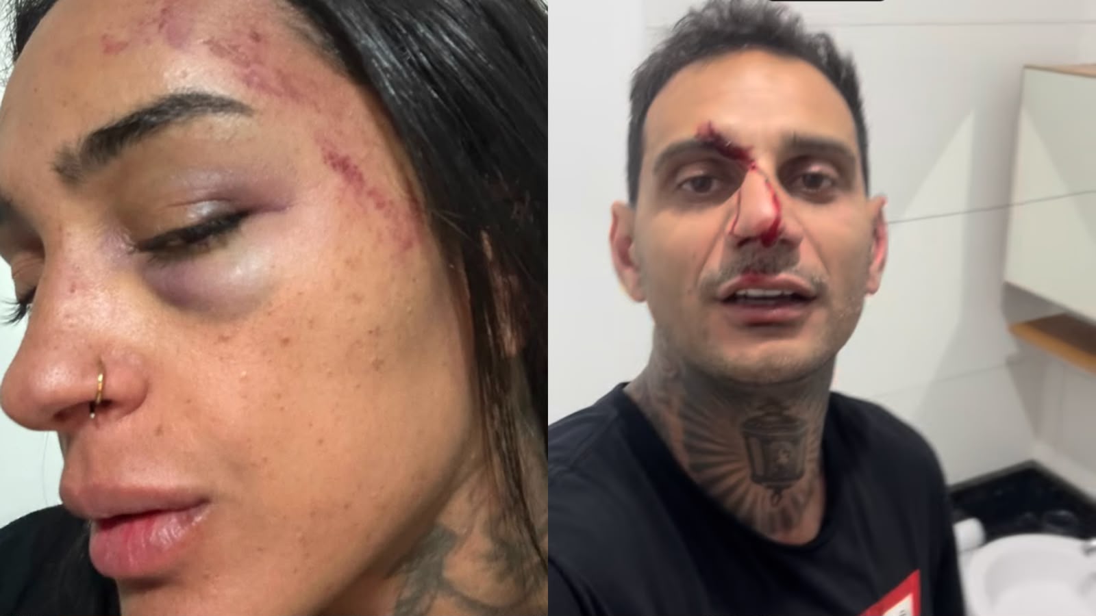 Acusado de agredir mulher em Florianópolis, Brenno Leal diz que se defendeu “na proporcionalidade”