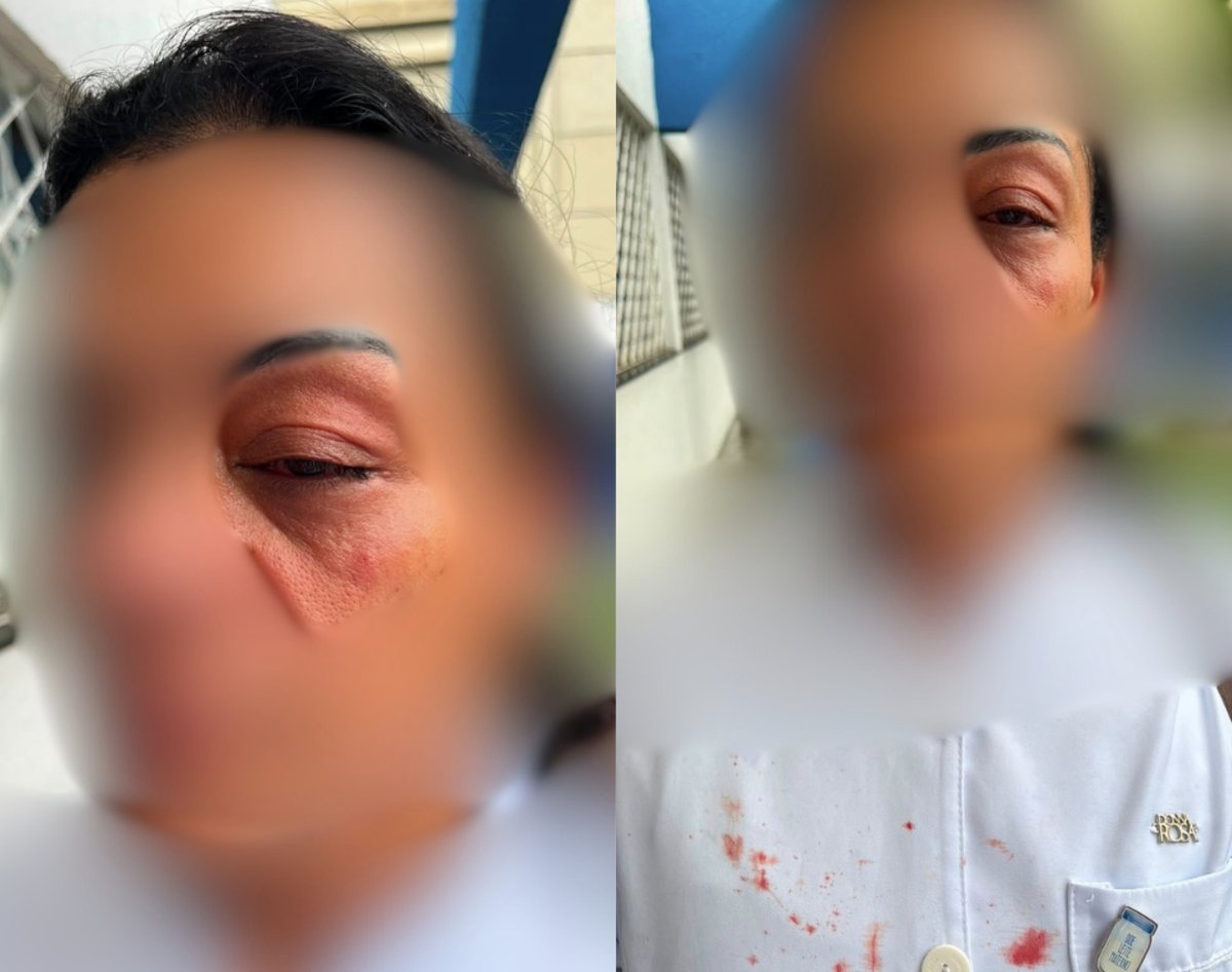 Enfermeira do CEO de Balneário Camboriú ferida após as agressões