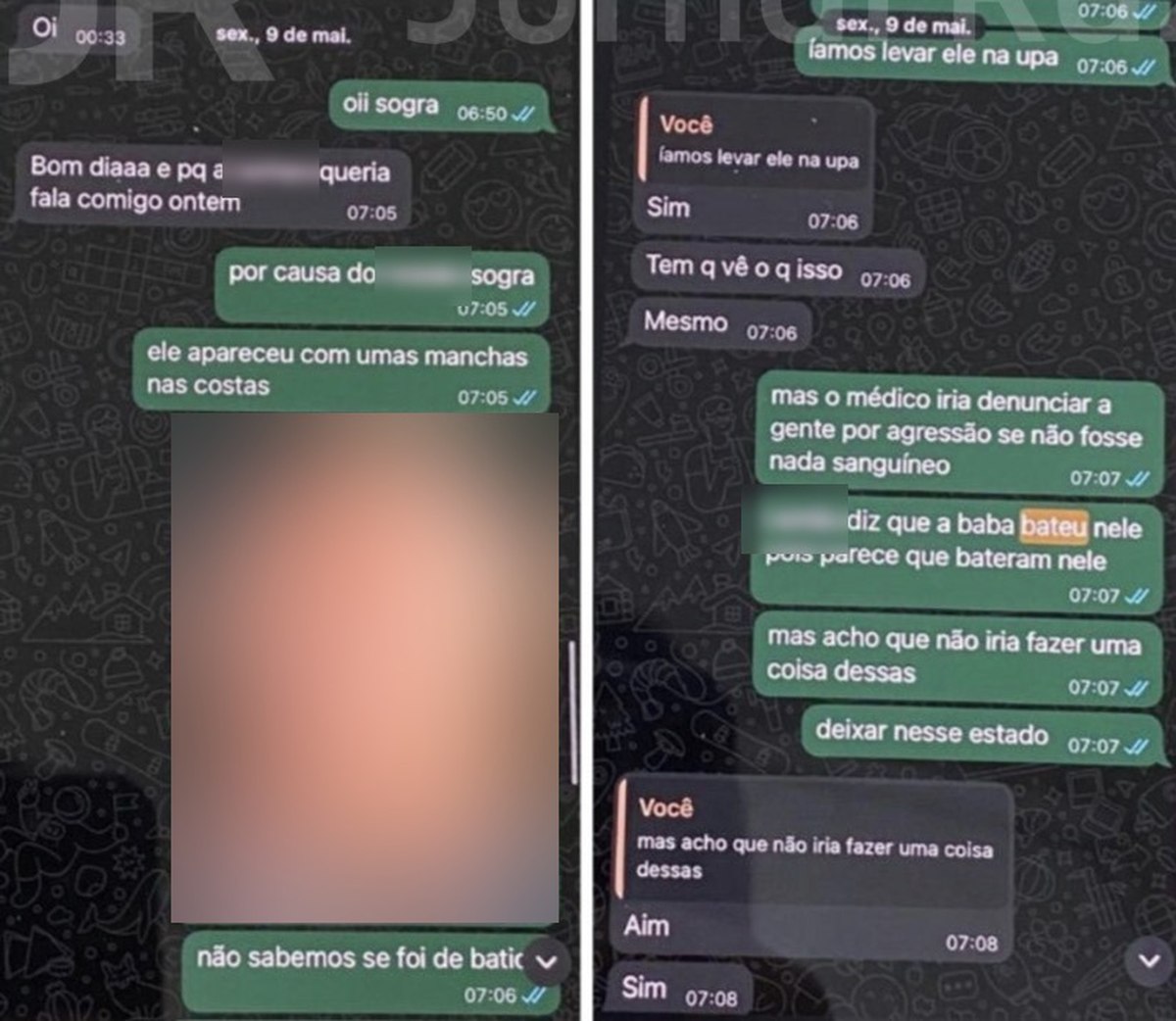 Em maio, o padrasto avisou a sogra sobre manchas no corpo da criança e culpou uma babá (Foto: Reprodução)