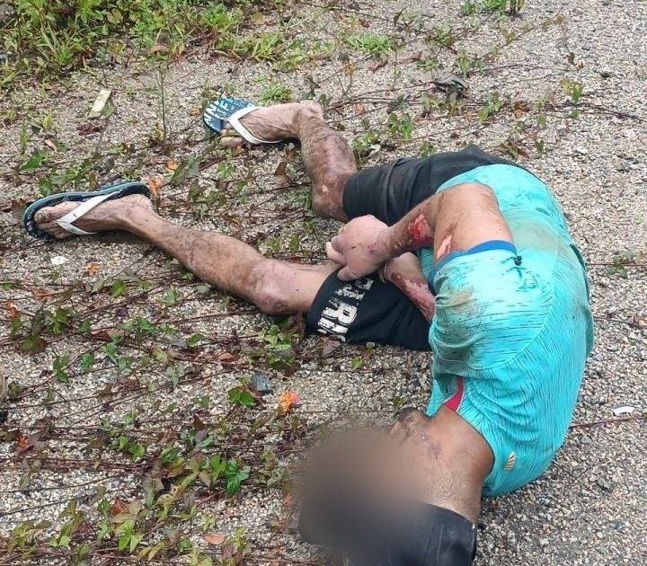 Homem diz que foi deixado dois dias amarrado em cima de formigueiro em Biguaçu