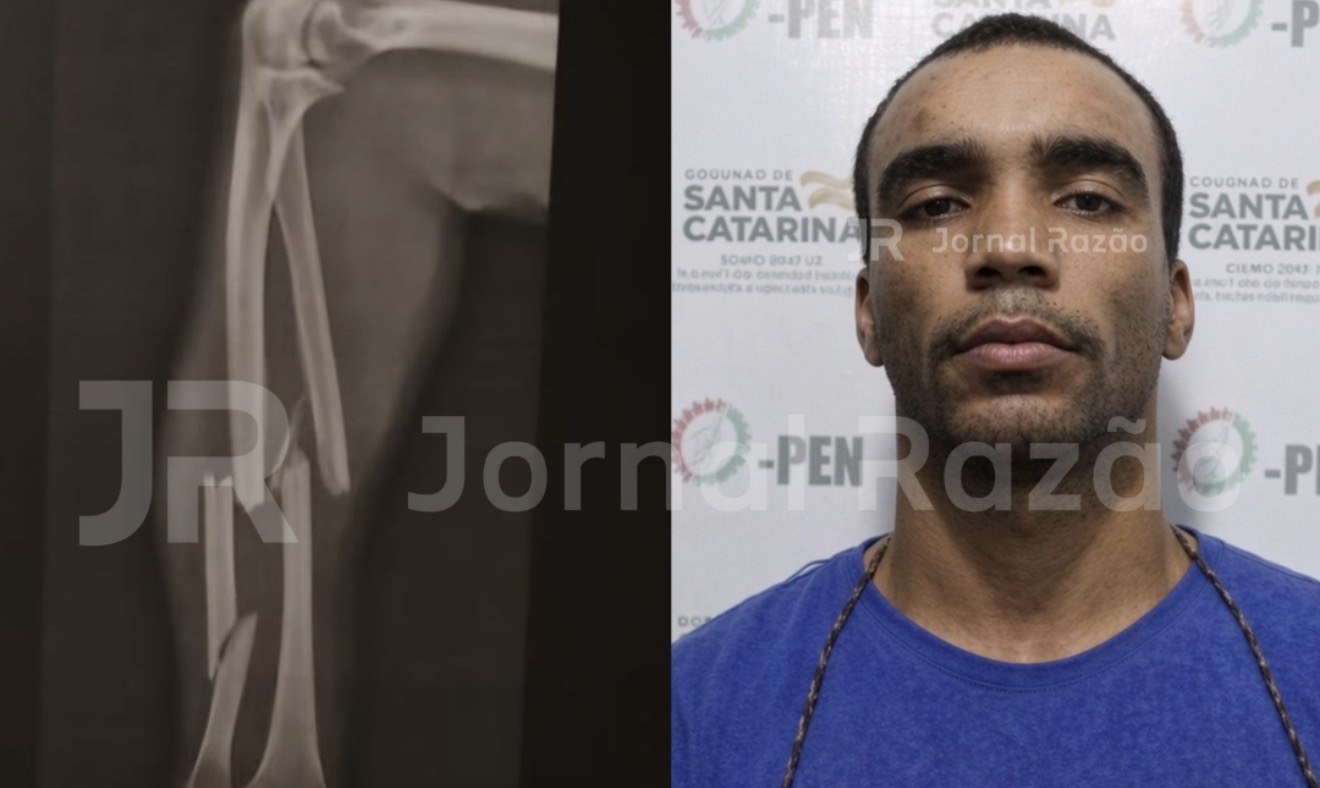 Homem se irrita com caixa de som ligada e tenta matar mulher em Tijucas