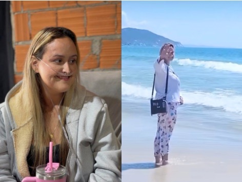 “Aproveitem a saúde de vocês”, pede Carolina Estevão, de Florianópolis, que vive com 32% dos pulmões e espera transplante