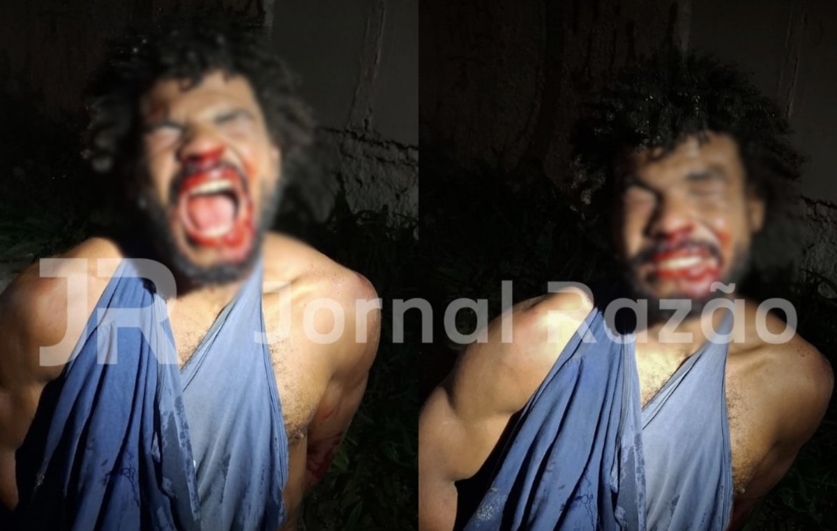 Antonio Lucas Marques Dias foi preso pela PMSC depois de morder a mão de um policial em Criciúma