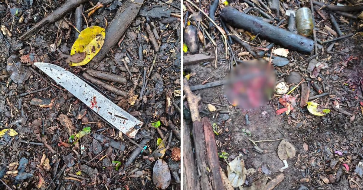 Homem é atacado na cabeça e no pescoço e acaba em estado grave em Itajaí