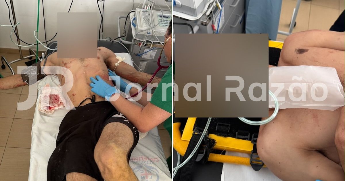 PMSC procura dupla em moto que esfaqueou jovem pelas costas no Vale do Rio Tijucas