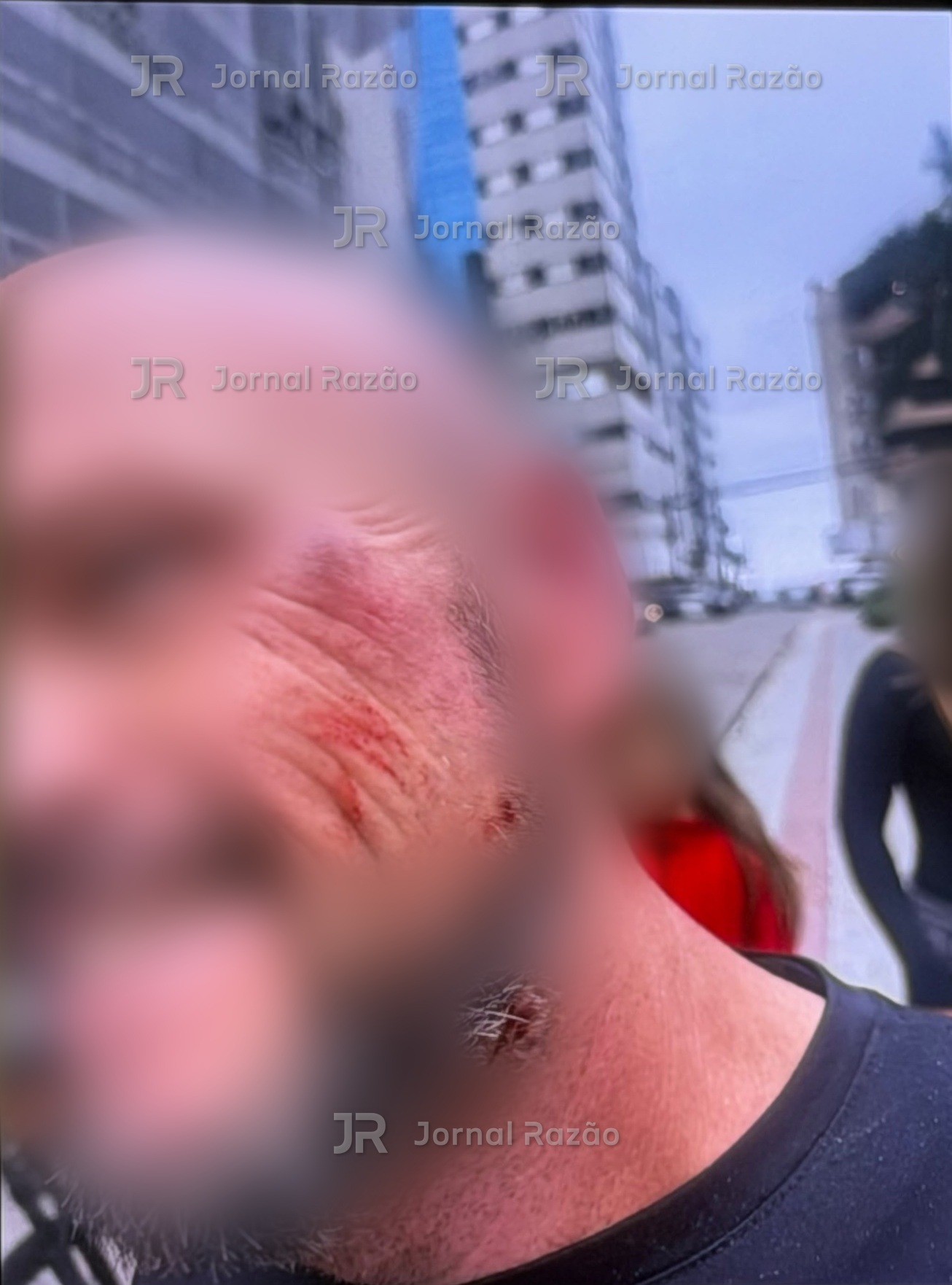Foto mostra as marcas no rosto da vítima; a imagem foi desfocada para não identificar o homem