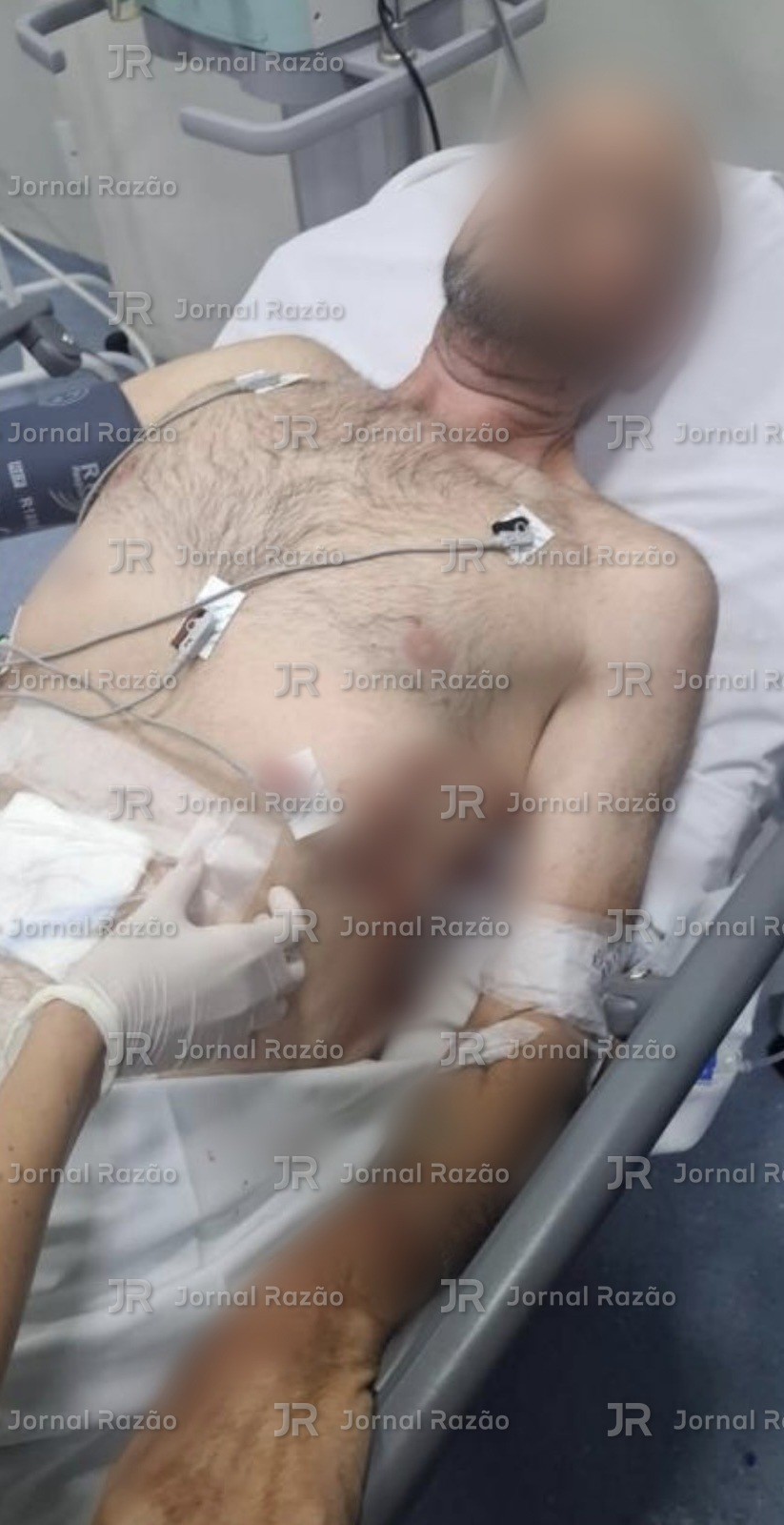 Vítima no hospital depois das facadas; o rosto e os ferimentos foram desfocados
